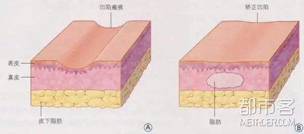 医美颜习社|面部短板不可怕 请先告别网红塑料感